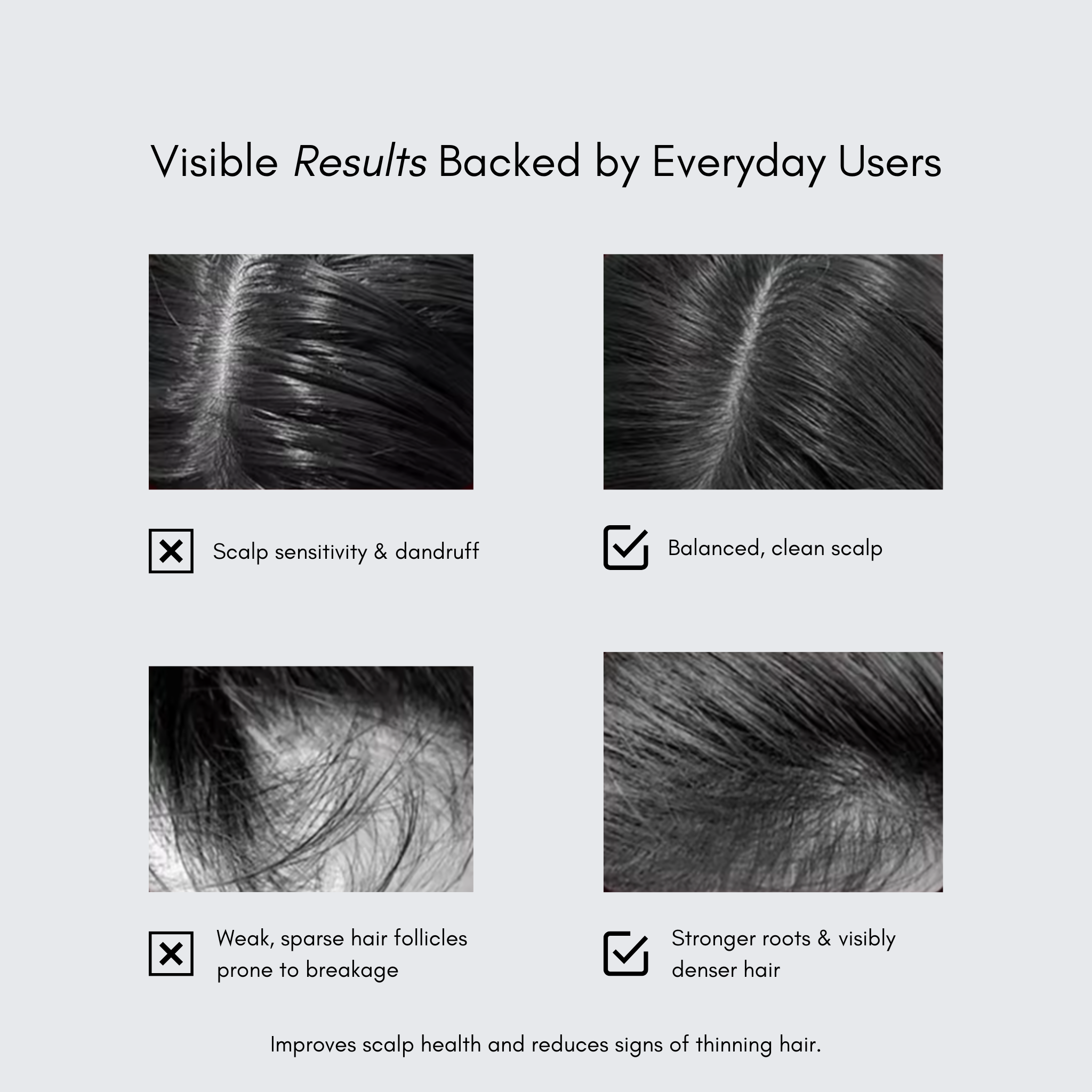 GrowLite LED Hair Growth Massaging Brush